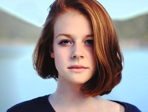 Desequilíbrio de bactérias pode ser causa da acne