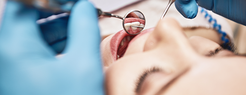 Gengivite e distúrbios cardíacos