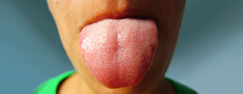 Exame de saliva para detectar Alzheimer