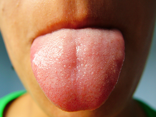 Exame de saliva para detectar Alzheimer