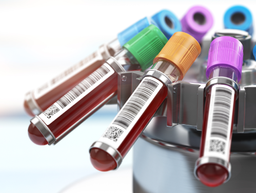 Novo exame de sangue para detectar câncer de próstata