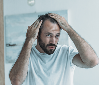 Calvície e genética