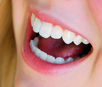 Antigo segredo dos bons dentes