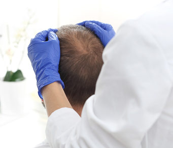 Células-tronco geram pele com cabelo