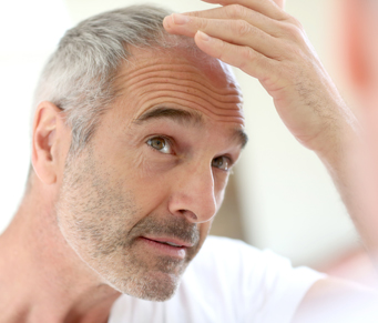 Esperança para calvície