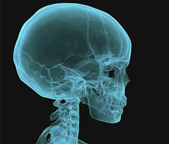 Esqueleto bem-vindo!