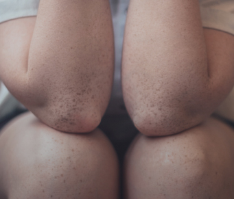 Tecnologia e o segredo dos gases intestinais