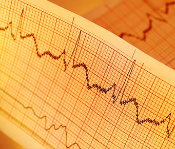 Obra-prima com problema cardíaco